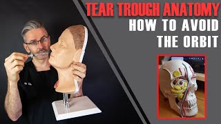 How NOT To Inject The Orbit: Vital Tear Trough Anatomy Tutorial [Aesthetics Mastery Show]