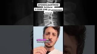 Mal di schiena e Spondiloartrosi: quando preoccuparsi?