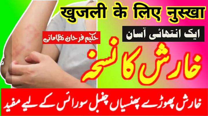 kharish ka ilaj || kharish ka nuskha ||     Hakeem...