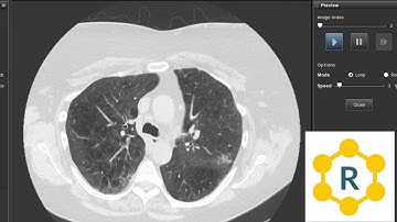 Slice Interval in CT
