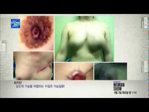 스토리온 우먼쇼 18화 미리보기