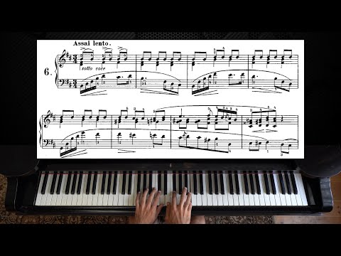 Chopin Prelude Op 28 No 6 Piano With Sheet Music