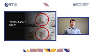 3MT 2020: Douglas Brown