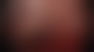 Bilateral eTEP for inguinal hernia - optical entry & placement of two different anatomical mesh