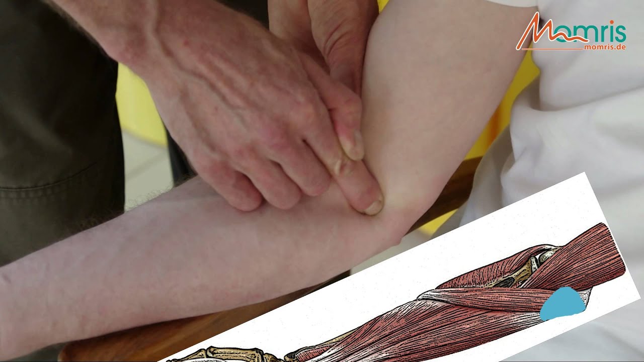 Schnelle Selbsthilfe bei Handgelenkschmerzen (Ellenbogenschmerzen, Tennisarm & Mausarm)