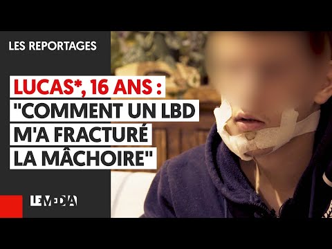 LUCAS*, 16 ANS : &quot;COMMENT UN LBD M&#039;A FRACTURÉ LA MÂCHOIRE&quot;