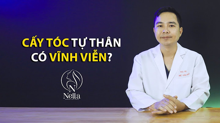 Đánh giá cấy tóc ở đâu uy tín năm 2024