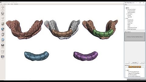 CSoD.Live.GrindStream  -  D3Mesh Virtual Vacuum Former (VVF) Part 1 of 4  -  Waxup Matrix