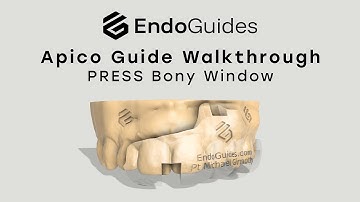 How to Use the Endo Guides Apicoectomy PRESS Bony Window Technique Surgical Guide