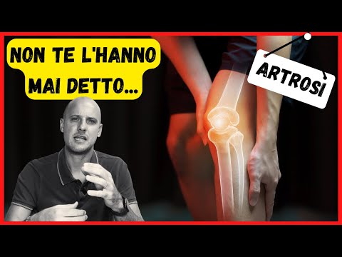 Anteprima video YouTube