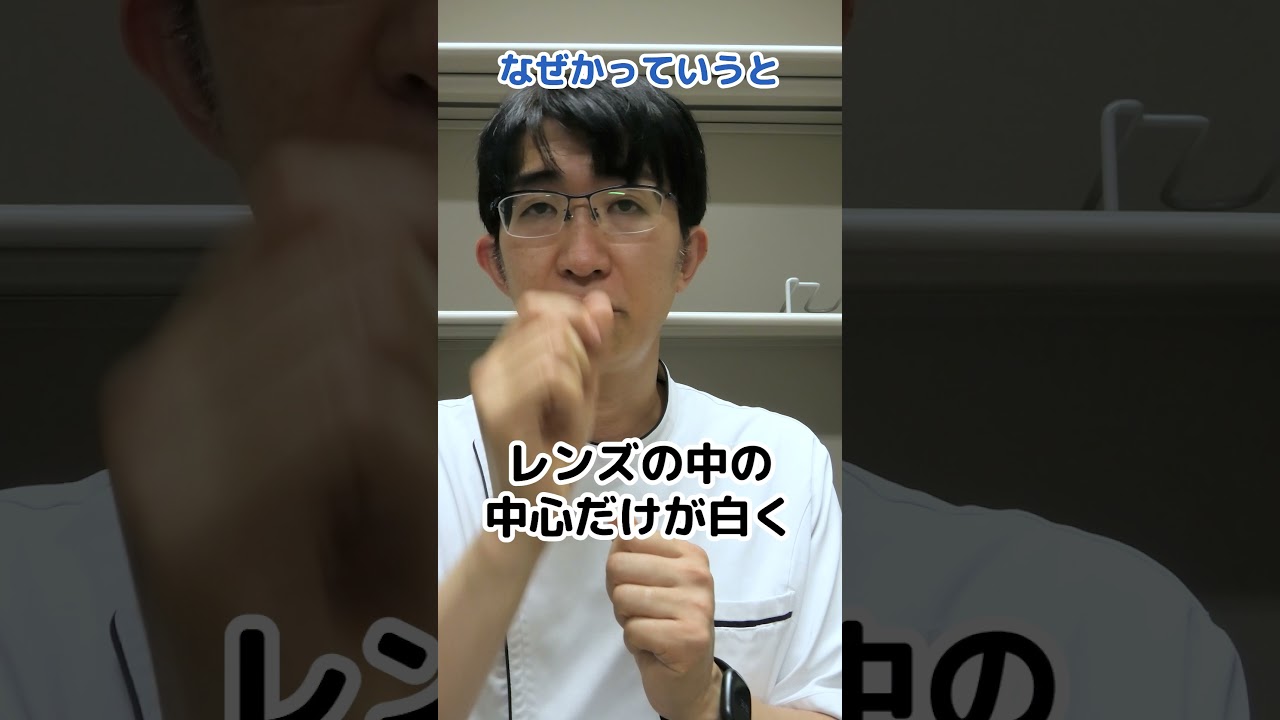 核白内障とは