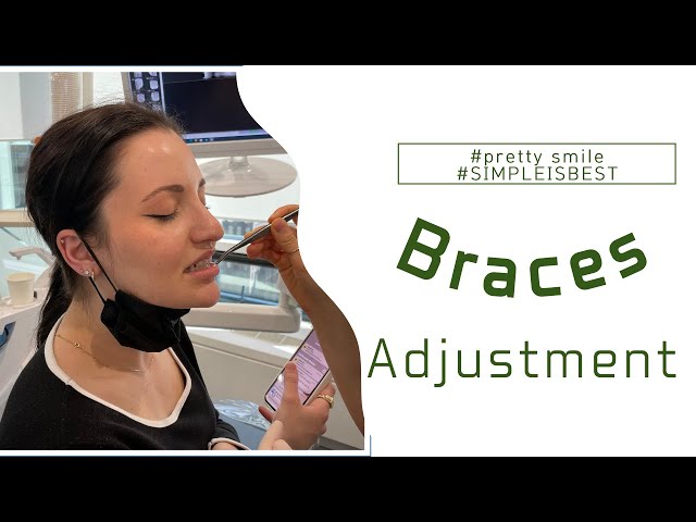 [Seouldentist] Braces Adjustment/ Tightening?