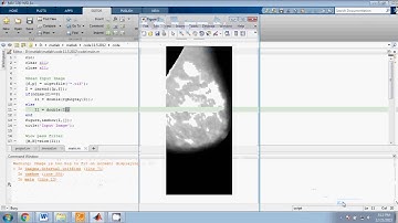 IEEE MATLAB BREAST CANCER DETECTION