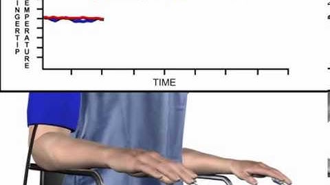 Endothelial Function Test VENDYS   The Hearts and Hands Movie