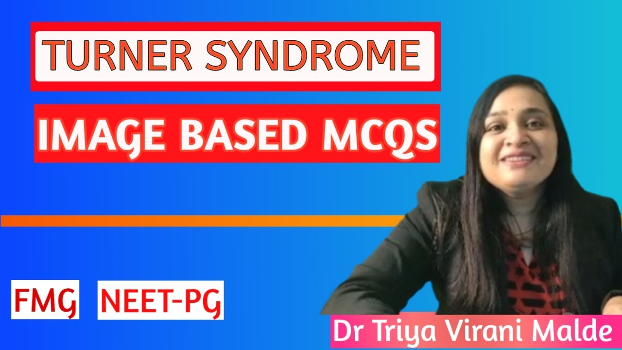 Turner Syndrome MCQs and Mnemonics Image based MCQs For NEET PG