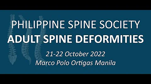 Primary degenerative sagittal imbalance