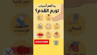 اسباب تورم القدمين#shortvideo @samirasmadi #معلومات #تغذيه_علاجيه