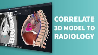 Complete Anatomy: Radiology Images screenshot 1