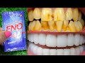 Eno का यह छोटा सा उपाय आपके गंदे पीले दांतो को चमका देगा Teeth Whitening Home Remedy/ Stain Removal