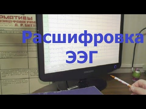 Расшифровка своей ЭЭГ: ритмы и волны, норма и патология