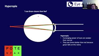 "Preparing for the FRCOphth Part 1 Exam" webinar series - Optics