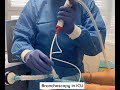 Bronchoscopy in icu