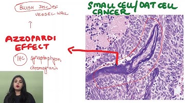 AIIMS Daily | High Yielding Topics Through MCQs By Dr. Preeti Sharma