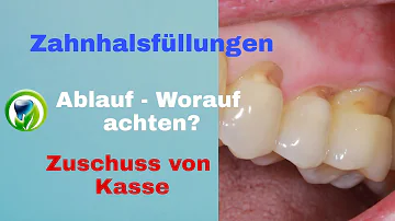 Was kostet eine Zahnhals Versiegelung?