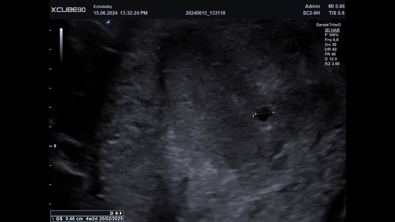 Pretecho 4 Weken Foto's