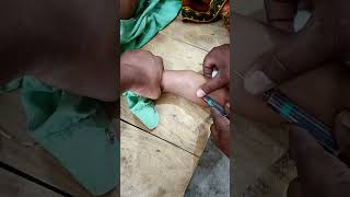 #nursing #staff #blood #pathology #test #real #viral