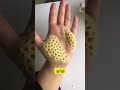 فوبيا الثقوب Youtubeshorts Youtube Explore Like فوبيا الثقوب Youtubeshorts Youtube Explore Like