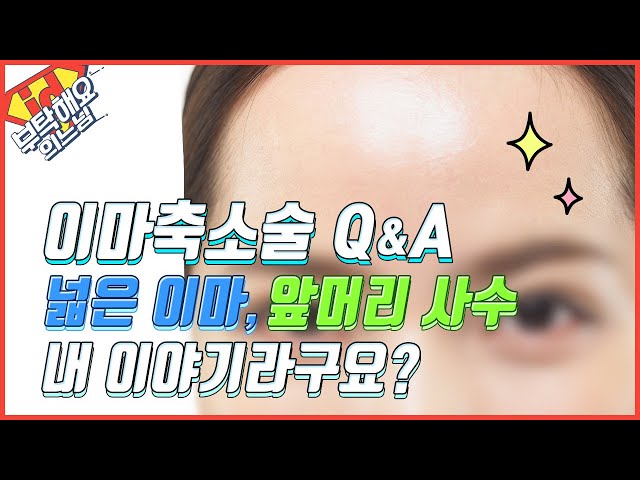 넓은 이마, M자 이마, 앞머리 사수 내 이야기라구요? 이마축소술 알아보기│부탁해요의느님👨‍⚕