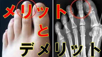 【知っ得！】足の人差し指が長いメリットと一生影響するデメリット...【雑学倉庫】