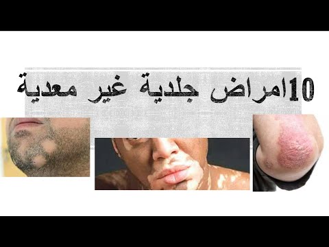 🔔📝 أشهر 10 امراض جلدية غير معدية 💯