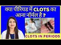 क्या पीरियड में CLOTS का आना नॉर्मल है ?