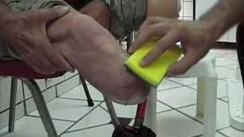 Como é feita a dessensibilização do coto?
