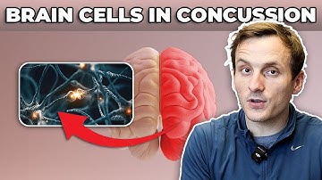 What ACTUALLY Happens in The Brain After a Concussion | Neuroscience Explained