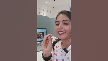 ഒരുപാട് Food Items ആയി ATR Miss വരുന്നു🥘🍟🥙