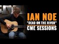 Ian Noe "Dead On The River" | Live At Chicago Music Exchange | CME Sessions