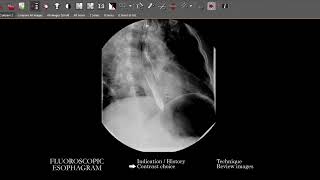 [FL] Esophagram | Search Pattern