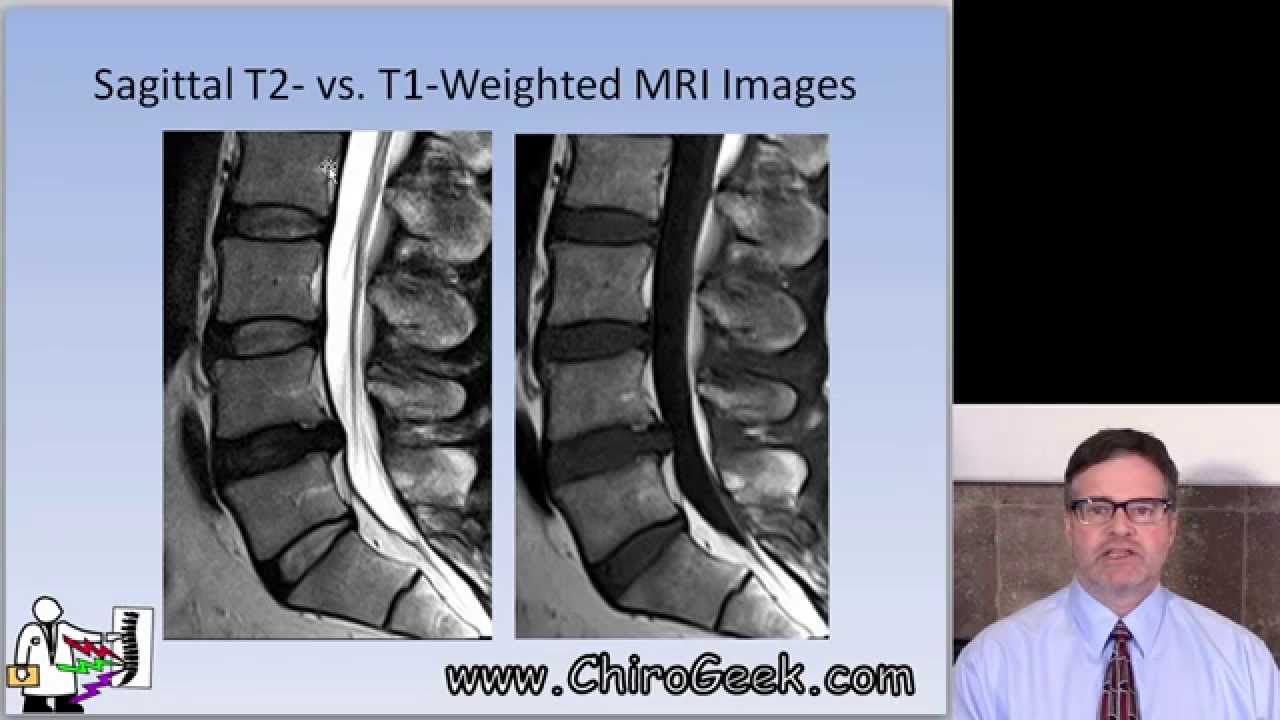 Does Lumbar Mri Show Bladder?