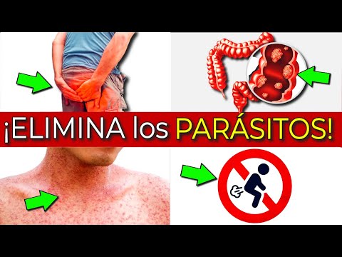 Video: Los Hechos Sobre los Tratamientos Spot-On Parasite
