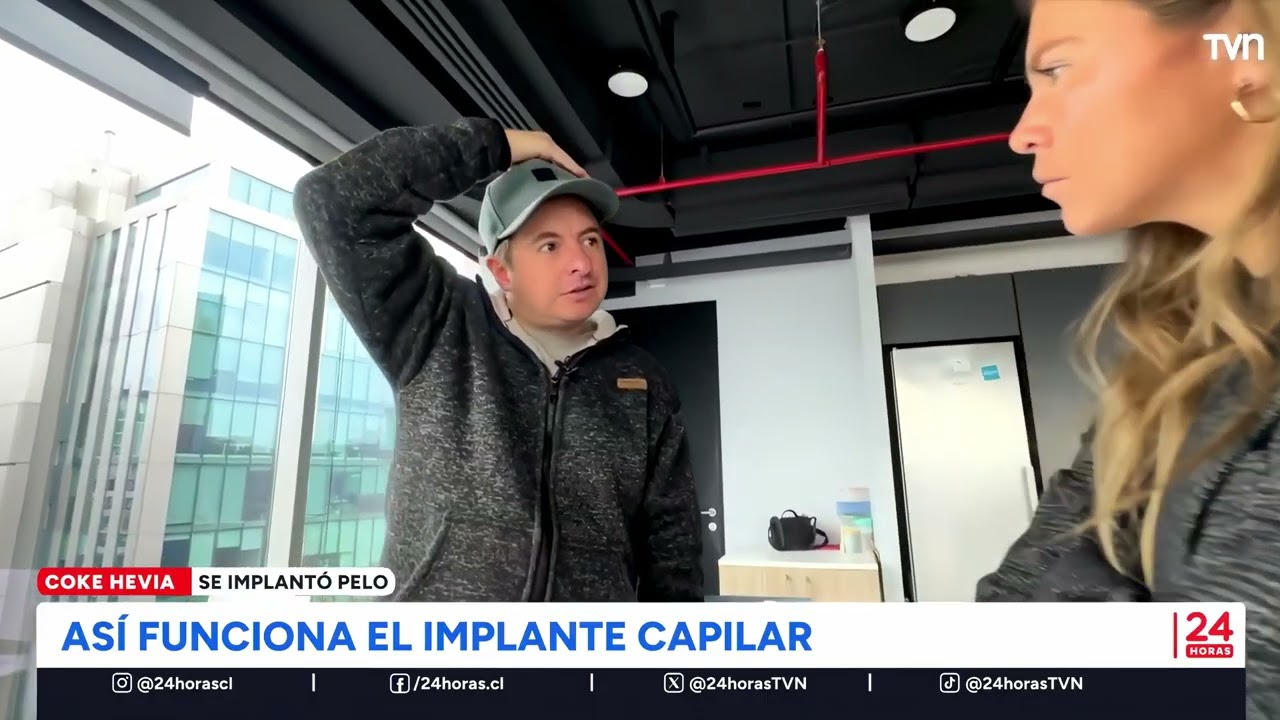 IMPLANTE CAPILAR JORGE HEVIA - REPORTAJE 24 HORAS - CLÍNICA TÉMPORA
