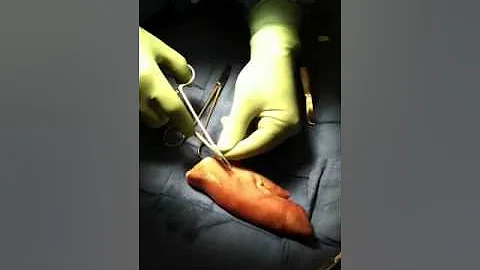 How to suture - Vein Specialists of the South - Dr...