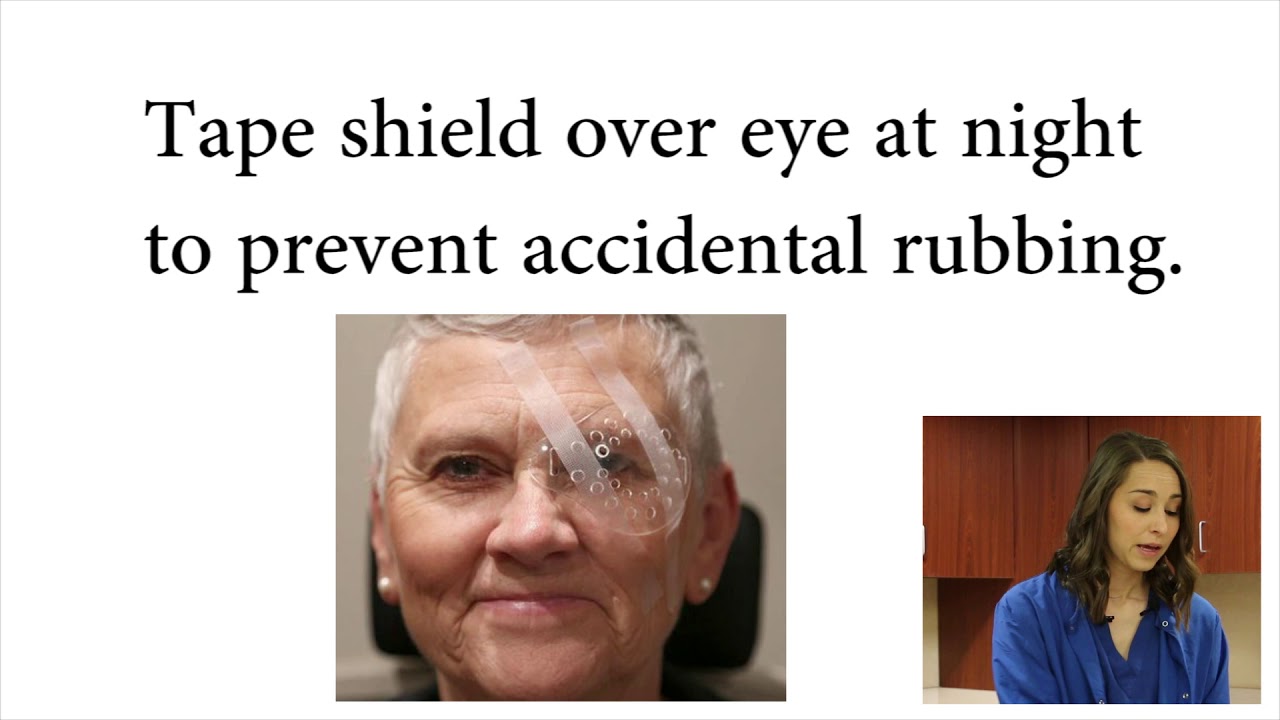 Instructions for patients after cataract surgery YouTube