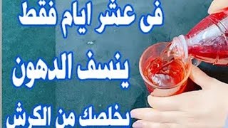 اشربيها طول شهر رمضان وهتخسي 40كيلو حضريها في قزازه واحده/ وهتاكلي كل حاجه بدون حرمان