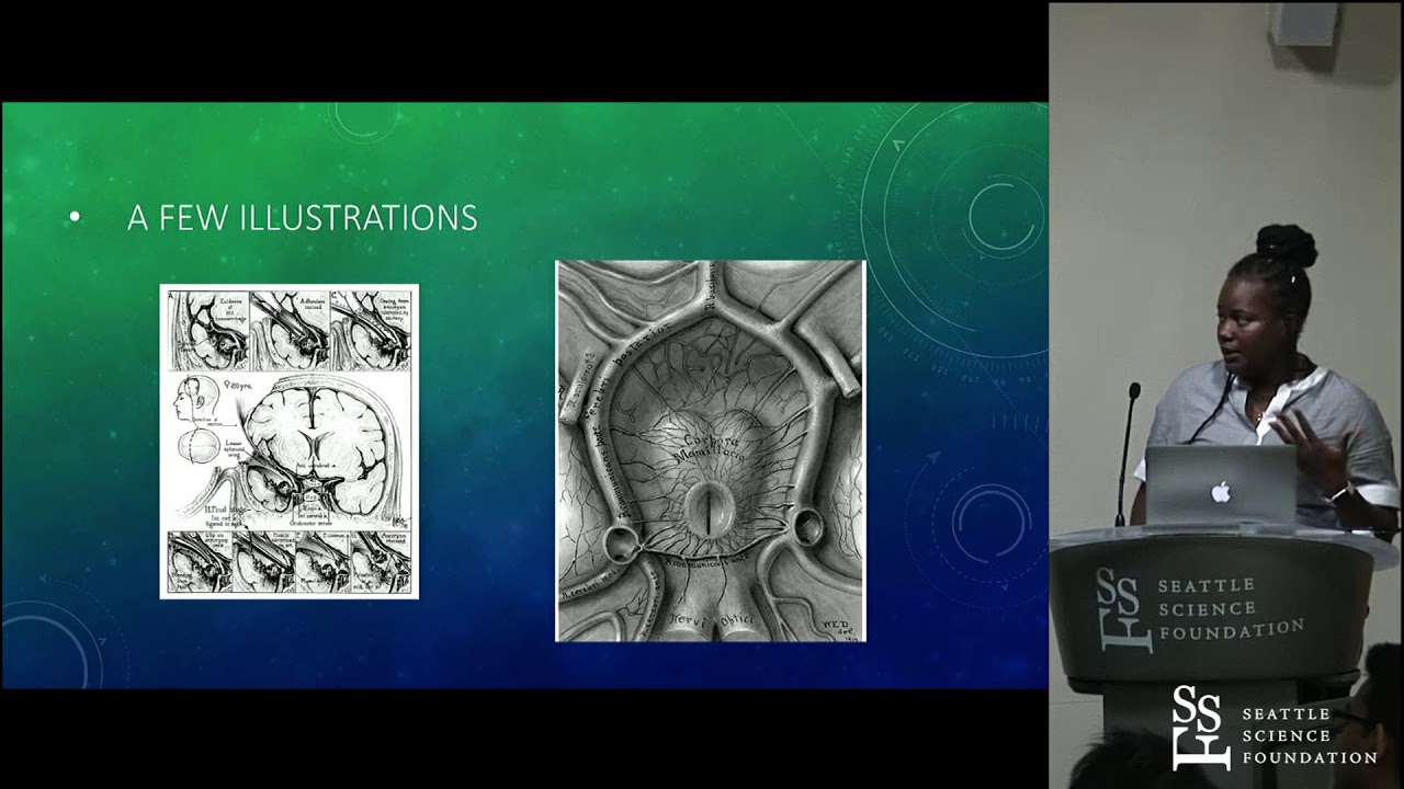Spinal dysraphism from the eyes of Dorcas Padget - Naomi Ojumah, MD