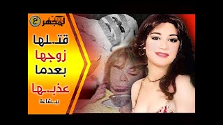 المغنية التركية التي عذبـ ـها زوجها بحـ ـرقها بمادة خطـ ـيرةوفقـ ـدانها لعينها ثم قتـ ـلها ببـ ـشاعة