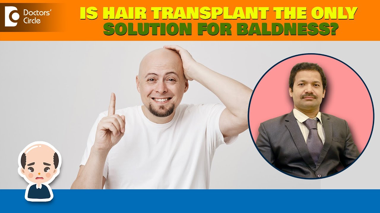 7 Baldness Treatment Medical Options other than Hair Transplant-Dr Deepak P Devakar| Doctors' Circle