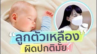 ลูกตัวเหลือง ภาวะตัวเหลืองในทารกแรกเกิด การส่องไฟทารกตัวเหลือง ค่าตัวเหลืองเท่าไหร่ปกติ